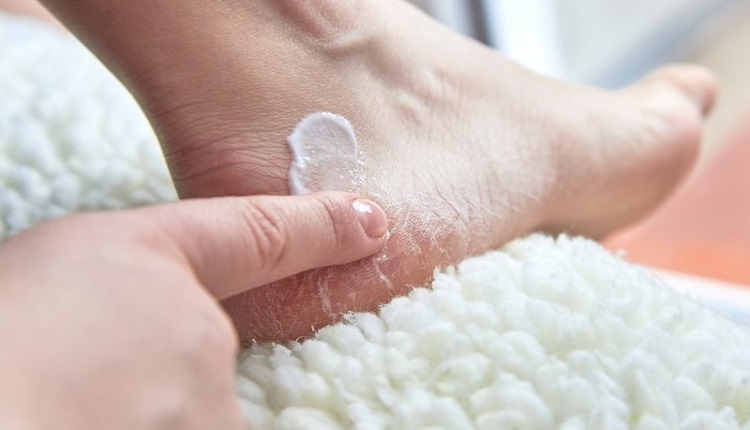 % بررسی علت ترک پا و نحوه درمان آن با بهترین کرم‌ها